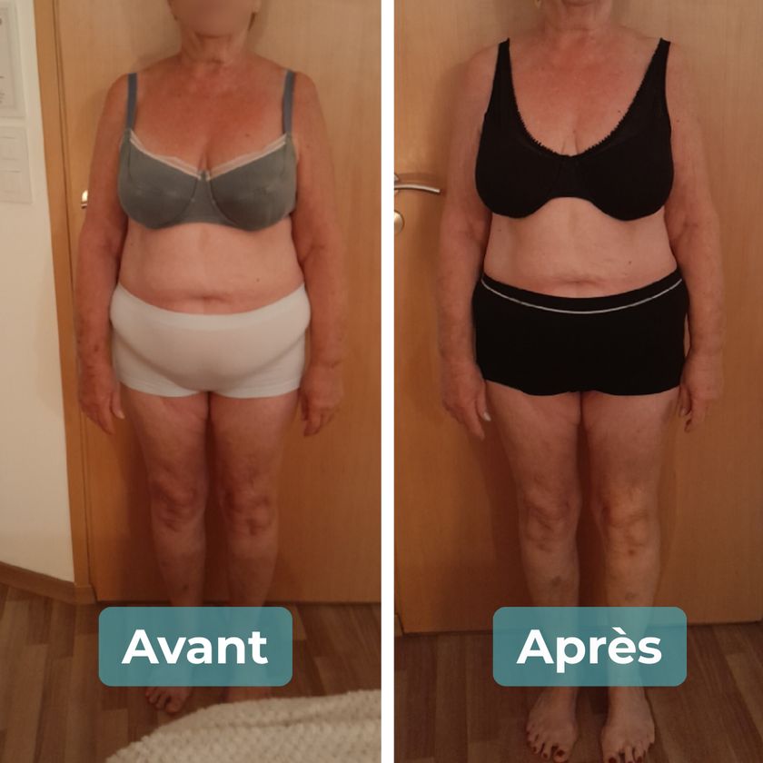Photo avant et après un accompagnement MAbeautyplus