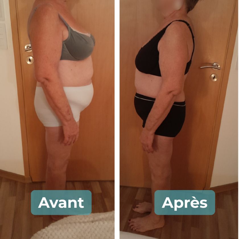 Photo avant et après un accompagnement MAbeautyplus