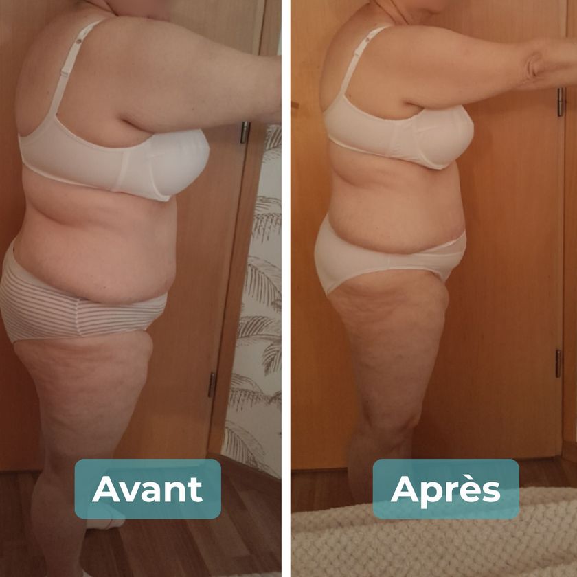 Photo avant et après un accompagnement MAbeautyplus