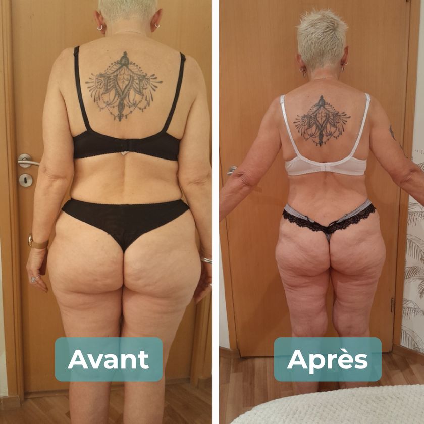 Photo avant et après un accompagnement MAbeautyplus
