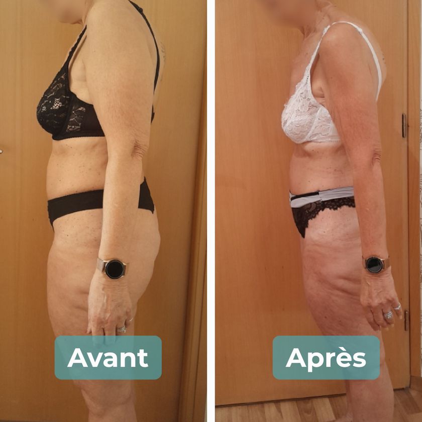 Photo avant et après un accompagnement MAbeautyplus