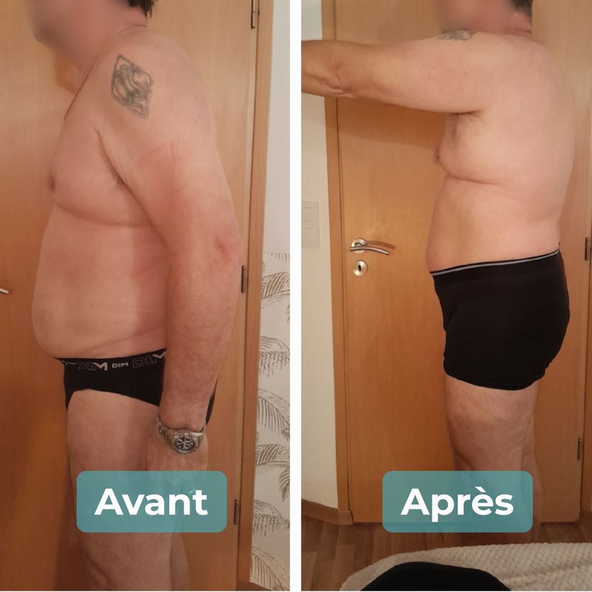 Photo avant et après un accompagnement MAbeautyplus