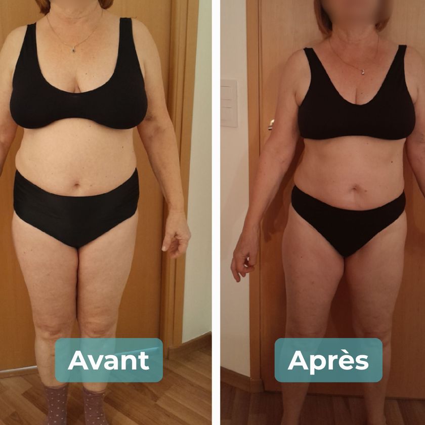Photo avant et après un accompagnement MAbeautyplus
