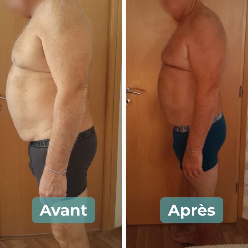 Photo avant et après un accompagnement MAbeautyplus
