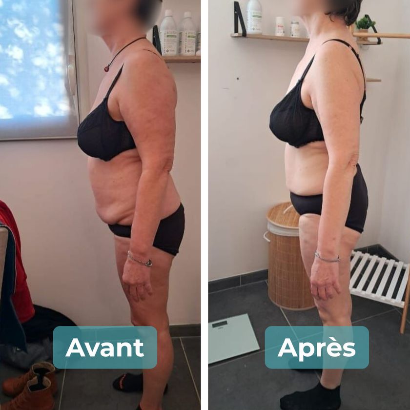 Photo avant et après un accompagnement MAbeautyplus